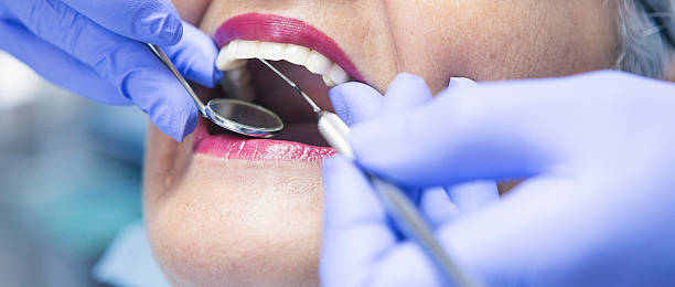 Best Emergency Root Canal Treatment in Gadsden, AL